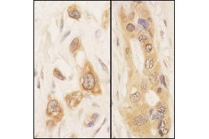 Immunohistochemistry (IHC) image for anti-serine threonine Kinase 39 (STK39) (AA 375-425) antibody (ABIN7453840) (STK39 Antikörper  (AA 375-425))