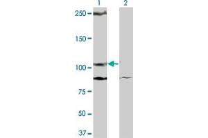 Western Blot analysis of KIT expression in transfected 293T cell line by KIT monoclonal antibody (M08), clone 2C3. (KIT Antikörper  (AA 41-140))