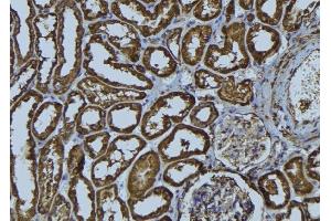 ABIN6274024 at 1/100 staining Rat kidney tissue by IHC-P.