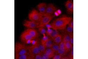 Immunofluorescenitrocellulosee of HaCaT cells stained with Hoechst 3342 (Blue) for nucleus staining and monoclonal anti-human beta-Tubulin antibody (1:1000) with Texas Red (Red). (TUBB Antikörper  (AA 1-445))