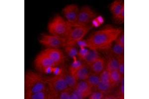Immunofluorescenitrocellulosee of HaCaT cells stained with Hoechst 3342 (Blue) for nucleus staining and monoclonal anti-human beta-Tubulin antibody (1:1000) with Texas Red (Red).