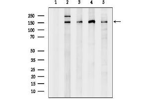 anti-PH Domain and Leucine Rich Repeat Protein Phosphatase 2 (PHLPP2) (C-Term) antibody