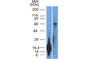 Western Blot Analysis of TRIM29 Recombinant protein fragment & A431 cell lysate TRIM29 Monoclonal Antibody (TRIM29/1042). (TRIM29 Antikörper  (AA 1-200))