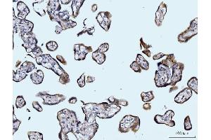 IHC analysis of Glutaminase/GLS using anti-Glutaminase/GLS antibody (ABIN7601602).