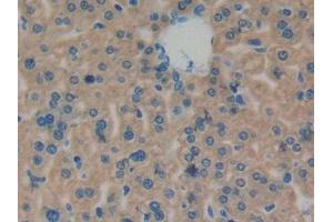 DAB staining on IHC-P; Samples: Mouse Liver Tissue (CPT1A Antikörper  (AA 568-773))