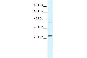WB Suggested Anti-FREQ Antibody Titration:  0.