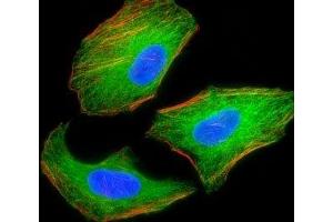 Immunofluorescence (IF) image for anti-Tuberous Sclerosis 2 (TSC2) antibody (ABIN3029333)