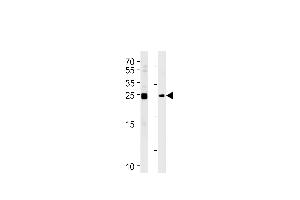 MOB4A Antibody (C-term) (ABIN391030 and ABIN2841198) western blot analysis in Daudi,K562 cell line lysates (35 μg/lane). (MOBKL1A Antikörper  (C-Term))
