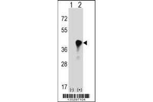 Western blot analysis of C4BPB using rabbit polyclonal C4BPB Antibody using 293 cell lysates (2 ug/lane) either nontransfected (Lane 1) or transiently transfected (Lane 2) with the C4BPB gene. (C4BPB Antikörper  (AA 125-153))