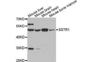 Western blot analysis of extracts of various tissues, using SSTR1 antibody.