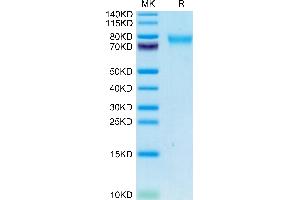 SDS-PAGE (SDS) image for Guanylate Cyclase 2C (Heat Stable Enterotoxin Receptor) (GUCY2C) (AA 21-430) protein (His tag) (ABIN7274714)