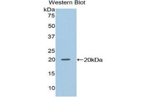 Detection of Recombinant NME2, Mouse using Polyclonal Antibody to Non Metastatic Cells 2, Protein NM23B Expressed In (NME2) (NME2 Antikörper  (AA 8-149))