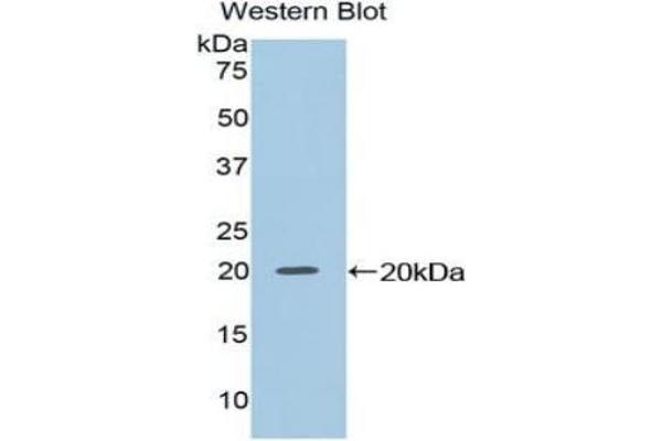 NME2 anticorps  (AA 8-149)