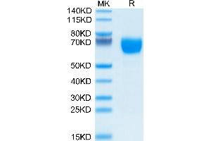 Human GM-CSF R alpha on Tris-Bis PAGE under reduced condition. (CSF2RA Protein (AA 23-320) (His tag))