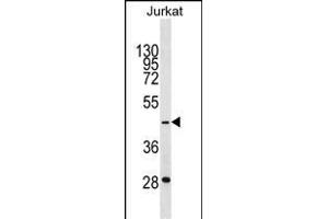 GTF3A Antibody (C-term) (ABIN1537104 and ABIN2850137) western blot analysis in Jurkat cell line lysates (35 μg/lane).