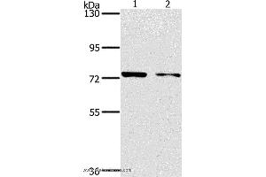 Western blot analysis of MCF7 and hela cell, using PPP1R13L Polyclonal Antibody at dilution of 1:500 (PPP1R13L Antikörper)