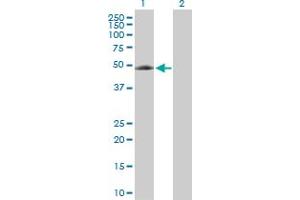 Western Blot analysis of EIF5 expression in transfected 293T cell line by EIF5 MaxPab rabbit polyclonal antibody. (EIF5 Antikörper  (AA 1-431))