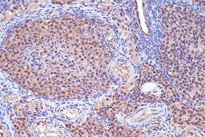 Immunohistochemistry of paraffin-embedded rat ovary using MSH2 Rabbit mAb (ABIN7268547) at dilution of 1:100 (40x lens). (MSH2 Antikörper)