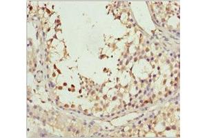 Immunohistochemistry of paraffin-embedded human testis tissue using ABIN7170649 at dilution of 1:100 (SPRED2 Antikörper  (AA 120-300))