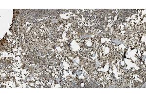 IHC analysis of U2AF65/U2AF2 using anti U2AF65/U2AF2 antibody (ABIN7600795).