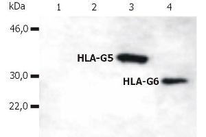 Western Blotting analysis of whole cell lysate of HLA-G stable transfectants (various splice variants) using anti-human HLA-G (5A6G7). (HLAG Antikörper  (C-Term) (PE))