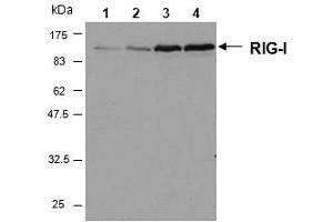 Western blot analysis of human RIG-I in HeLa cells by using RIG-I, mAb (Alme-1) . (DDX58 Antikörper  (AA 201-713))