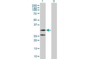 anti-C1q and Tumor Necrosis Factor Related Protein 2 (C1QTNF2) (AA 1-285) antibody