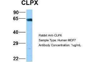 Host: Rabbit Target Name: NOP56 Sample Type: MCF7 Antibody Dilution: 1. (CLPX Antikörper  (C-Term))