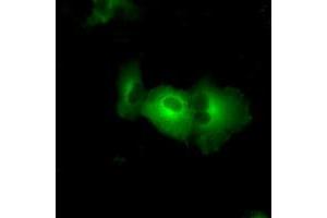 Image no. 2 for anti-PAS Domain Containing Serine/threonine Kinase (PASK) antibody (ABIN1500032)