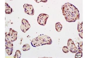 Formalin-fixed and paraffin embedded human placenta labeled with Rabbit Anti Phospho-Smad2(Ser245/250/255) Polyclonal Antibody, Unconjugated (ABIN746063) at 1:200 followed by conjugation to the secondary antibody and DAB staining