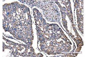 IHC analysis of SOD2 using anti-SOD2 antibody (ABIN7602799).