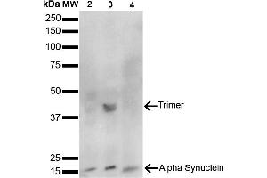 Western Blot analysis of Human, Mouse, Rat Brain showing detection of 14 kDa Alpha Synuclein protein using Mouse Anti-Alpha Synuclein Monoclonal Antibody, Clone 10H7 (ABIN5564083). (SNCA Antikörper  (FITC))