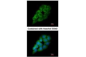 ICC/IF Image Immunofluorescence analysis of methanol-fixed A431, using DARS, antibody at 1:200 dilution. (DARS Antikörper)