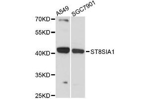 Western blot analysis of extracts of various cell lines, using ST8SIA1 antibody (ABIN5996532) at 1:3000 dilution. (ST8SIA1 Antikörper)