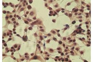 ICC staining of HeLa cell using control (rabbit Ig) at 5 ug/mL . (CYLD Antikörper  (AA 32-45))
