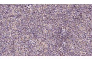 Immunohistochemistry (IHC) image for anti-NADH Dehydrogenase (Ubiquinone) Fe-S Protein 7, 20kDa (NADH-Coenzyme Q Reductase) (NDUFS7) (Internal Region) antibody (ABIN6263575)