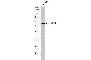 WB Image PAF49 antibody detects PAF49 protein by western blot analysis.