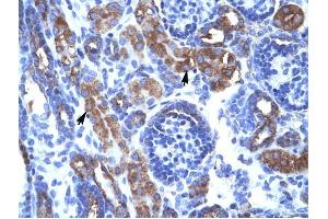 CHEK1 antibody was used for immunohistochemistry at a concentration of 4-8 ug/ml to stain Epithelial cells of renal tubule (arrows) in Human Kidney.