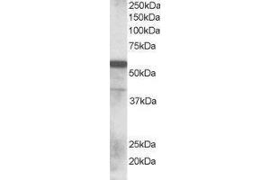 Western Blotting (WB) image for Ring Finger Protein 8 (RNF8) peptide (ABIN370148)