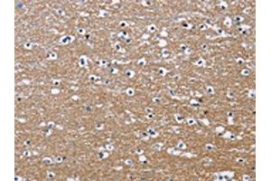 The image on the left is immunohistochemistry of paraffin-embedded Human brain tissue using ABIN7130690(PPP3CA Antibody) at dilution 1/30, on the right is treated with fusion protein. (PPP3CA Antikörper)