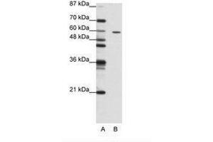 Image no. 1 for anti-Zinc Finger Protein 382 (ZNF382) (N-Term) antibody (ABIN202748) (ZNF382 Antikörper  (N-Term))