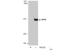 IP Image Immunoprecipitation of MYH9 protein from HeLa whole cell extracts using 5 μg of MYH9 antibody [N1], N-term, Western blot analysis was performed using MYH9 antibody [N1], N-term, EasyBlot anti-Rabbit IgG  was used as a secondary reagent. (Myosin 9 Antikörper  (N-Term))