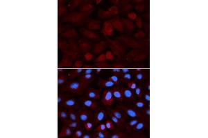 Immunofluorescence analysis of U2OS cells using ALDH3A1 antibody.