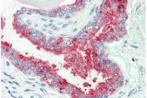 Anti-SLC12A2 / NKCC1 antibody  ABIN960804 IHC staining of human prostate.