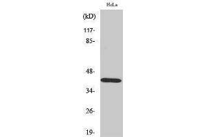 Western Blotting (WB) image for anti-serpin Peptidase Inhibitor, Clade B (Ovalbumin), Member 5 (SERPINB5) (Internal Region) antibody (ABIN3180164) (SERPINB5 Antikörper  (Internal Region))