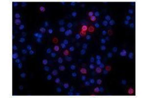 Immunofluorescence (IF) image for Goat anti-Armenian Hamster IgG antibody (DyLight 549) (ABIN2667267)