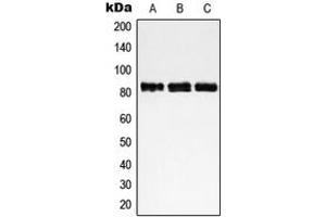 Western blot analysis of NCAPH expression in HeLa (A), Jurkat (B), MOLT4 (C) whole cell lysates.