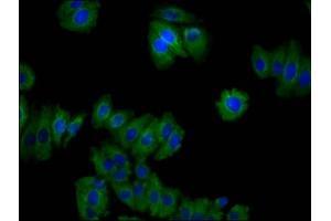 Immunofluorescence staining of HepG2 cells with ABIN7159453 at 1:100, counter-stained with DAPI. (Cyclin M2 Antikörper  (AA 739-875))