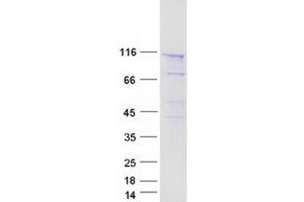 SEC24C Protein (Transcript Variant 2) (Myc-DYKDDDDK Tag)