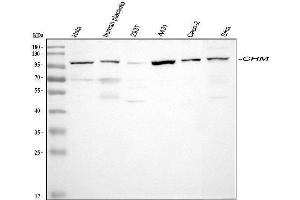 Western blot analysis of CHM using anti-CHM antibody (ABIN6719537).